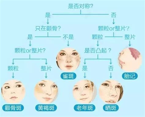 脸上长斑|中华医学会 科普图文 脸上的斑，傻傻分不清？